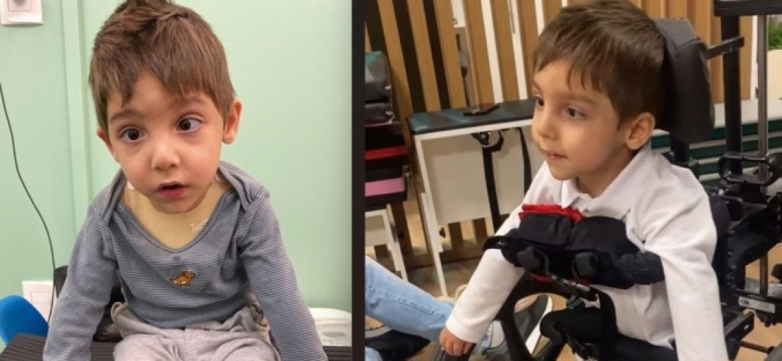 Família faz campanha para adquirir andador para criança com paralisia cerebral em São Ludgero