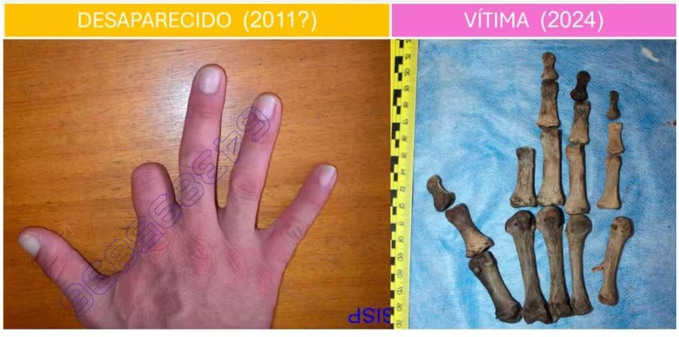 Após 12 anos, corpo de homem assassinado em Chapecó é identificado por análise de dedo mutilado