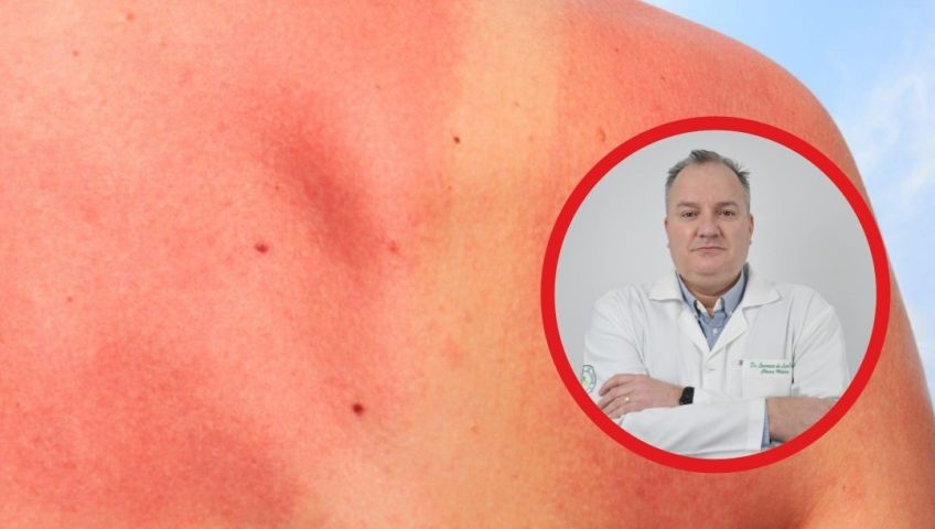 O perigo da insolação com as altas temperaturas