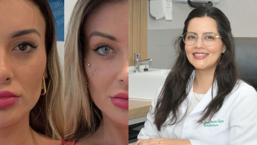 Olhos coloridos, visão em risco: médica alerta sobre cirurgia popular entre influenciadores