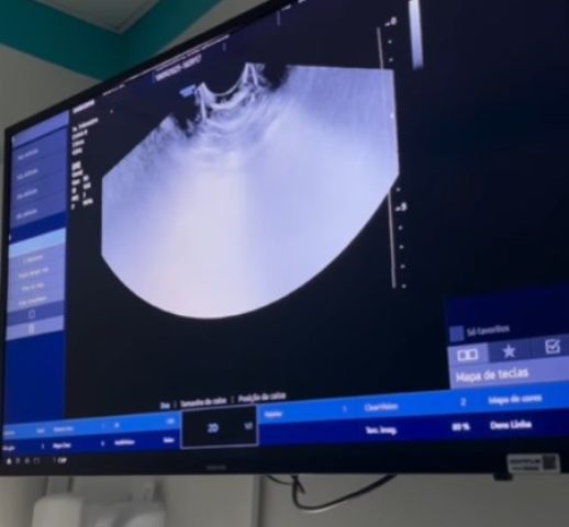 Vídeo: casal descobre que espera trigêmeos e viraliza