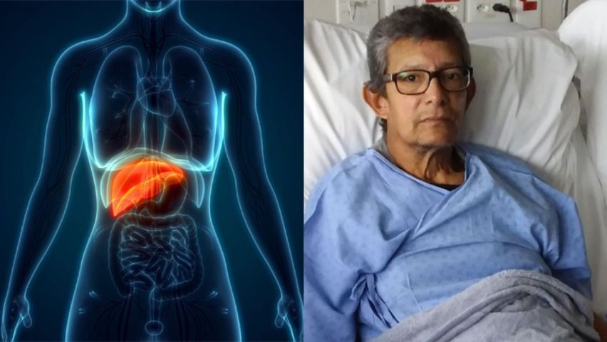 Brasil: homem descobre câncer em fígado transplantado