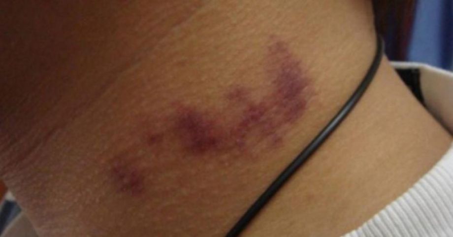 Homem é preso após sufocar e ameaçar matar companheira após término em Imbituba