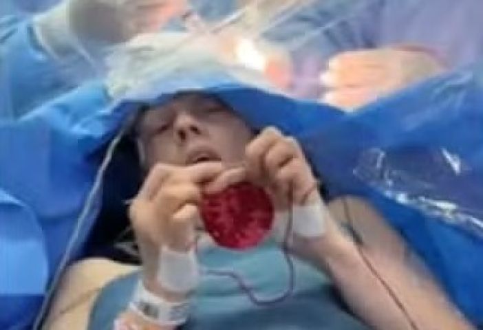 Paciente fica acordada e faz crochê enquanto médicos retiram tumor do cérebro
