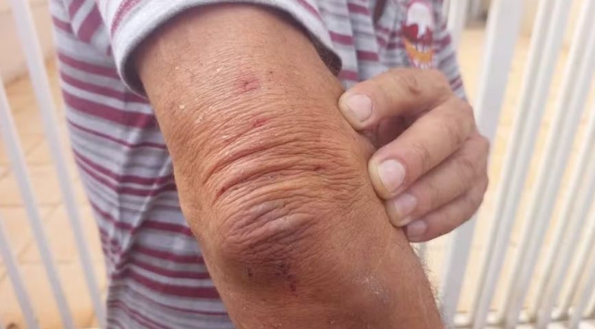 Idoso é agredido durante roubo em residência no Centro de Braço do Norte