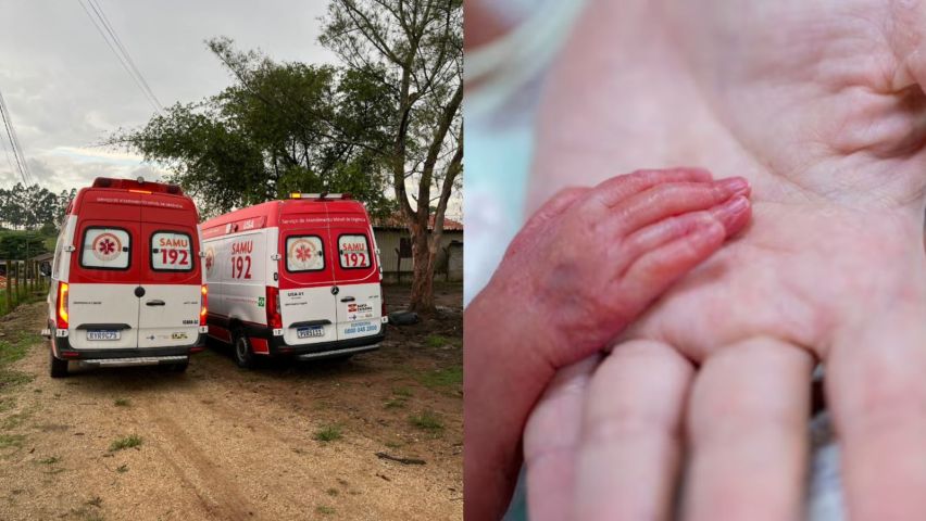 Prematuro de 6 meses é reanimado após parada cardiorrespiratória em Içara