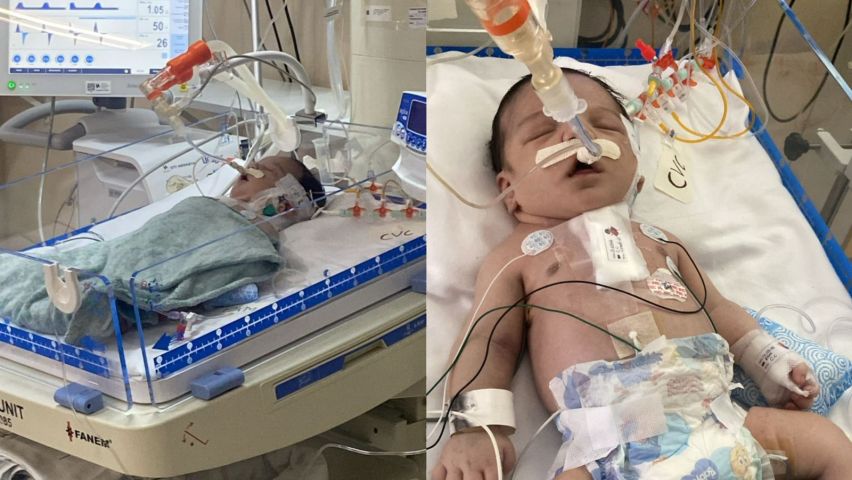 Família de Sombrio faz campanha para salvar bebê de 8 dias que precisa de cirurgia no coração