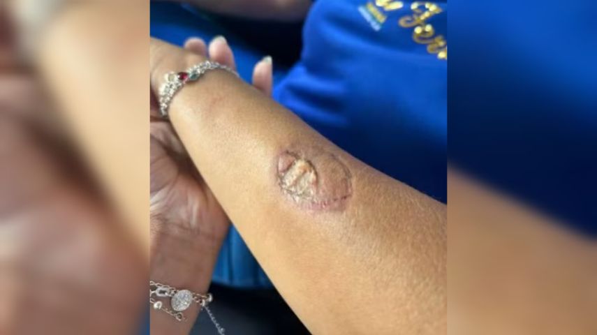 Mãe de aluno agride funcionárias e morde braço de vice-diretora em escola do Paraná