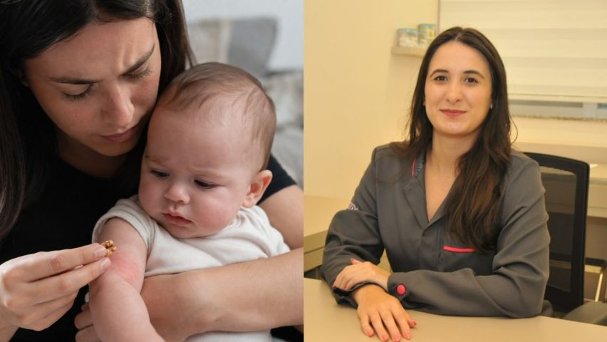 Saúde: esfregar alimento na pele do bebê não previne alergia