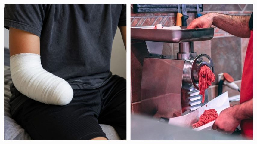 Em SC: Adolescente tem a mão amputada após acidente em moedor de carne