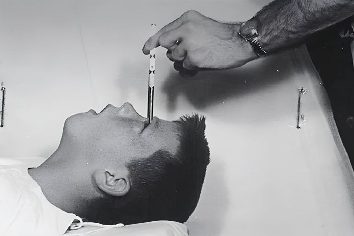 (Vídeo) Lobotomia: procedimento que perfurava o cérebro chegou a render Prêmio Nobel de Medicina