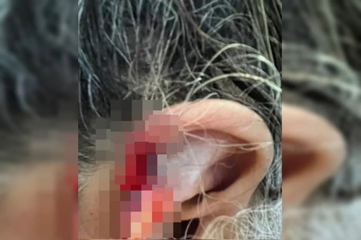 Neto é preso após arrancar e engolir pedaço da orelha da própria avó durante agressão