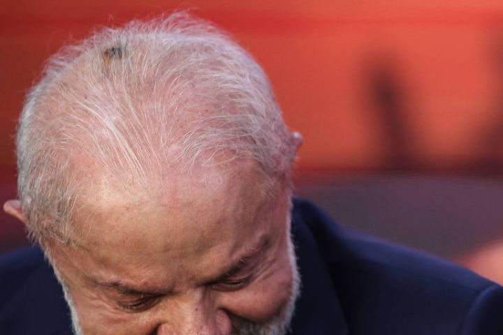 Lula realiza primeira sessão de radioterapia após retirar câncer de pele do couro cabeludo