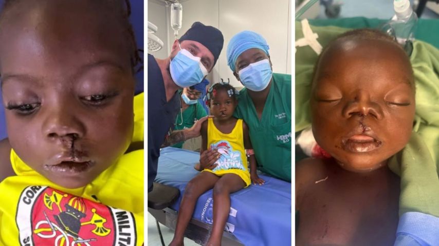 (Vídeo) Dentista de SC emociona ao fazer bebê angolano voltar a mamar após cirurgia gratuita