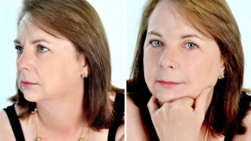 Empresária de 70 anos morre após passar por face lifting em clínica de SC e polícia investiga