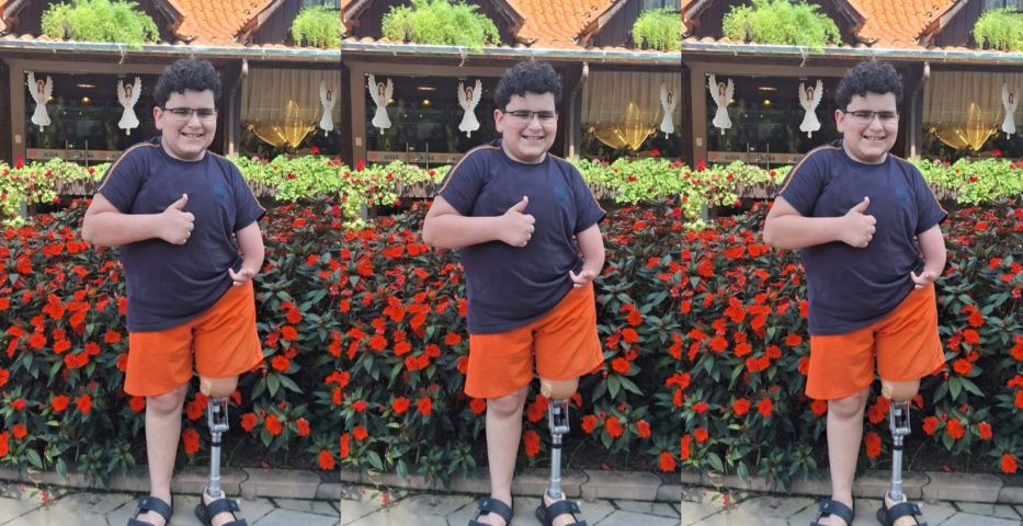 Comunidade se une em campanha solidária para ajudar Luan a trocar prótese pequena