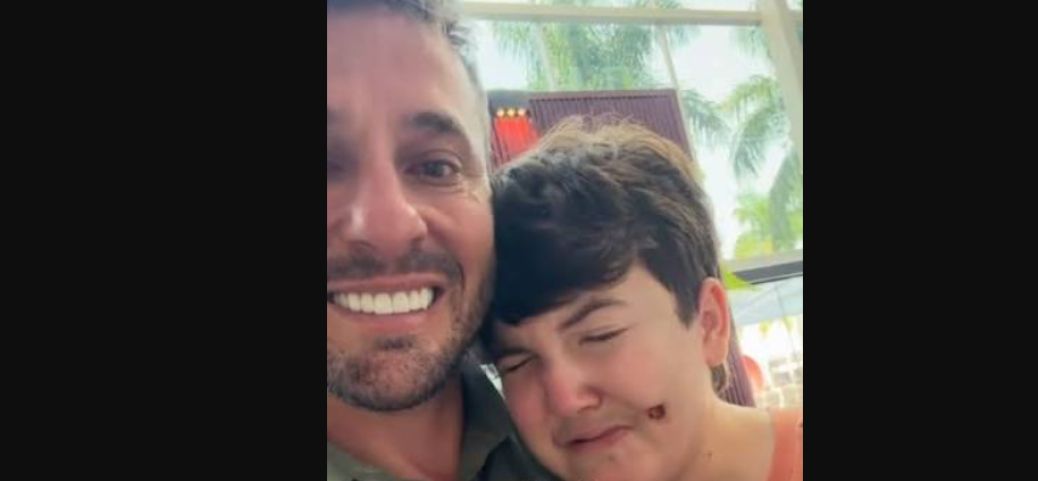 (Vídeo) Jovem de SC emociona ao reencontrar médico que reconstruiu seu rosto em cirurgia realizada por R$ 1