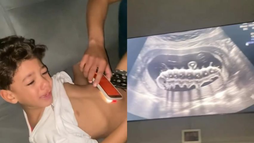 Pai finge ultrassom para flagrar verme e convencer filho a parar de comer doces; VÍDEO