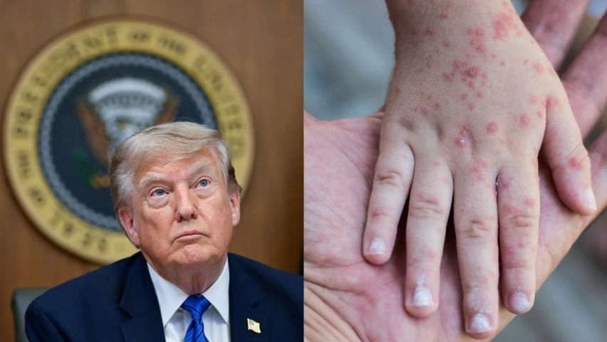 Governo Trump recua de política antivacina após pior surto de sarampo em 35 anos nos EUA