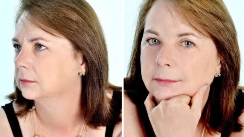 Dentista sem habilitação para cirurgia é indiciado por homicídio após morte de empresária de 70 anos em SC