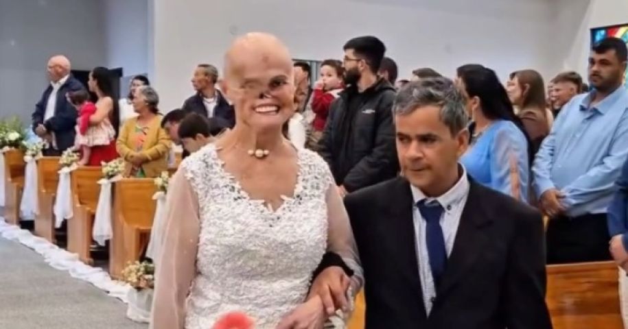 Em SC: mulher que enfrentou 73 cânceres se casa com homem que a acompanhava nos hospitais