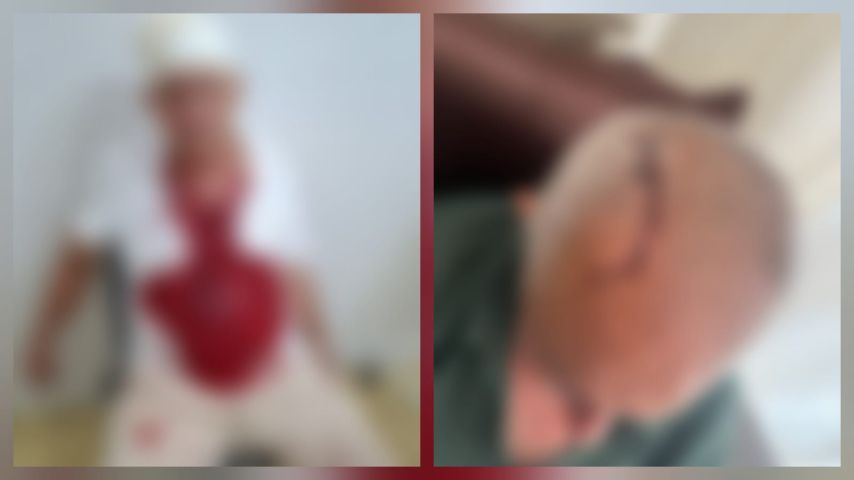 Homem de 70 anos fica ferido após ser agredido com um taco de beisebol, em Armazém