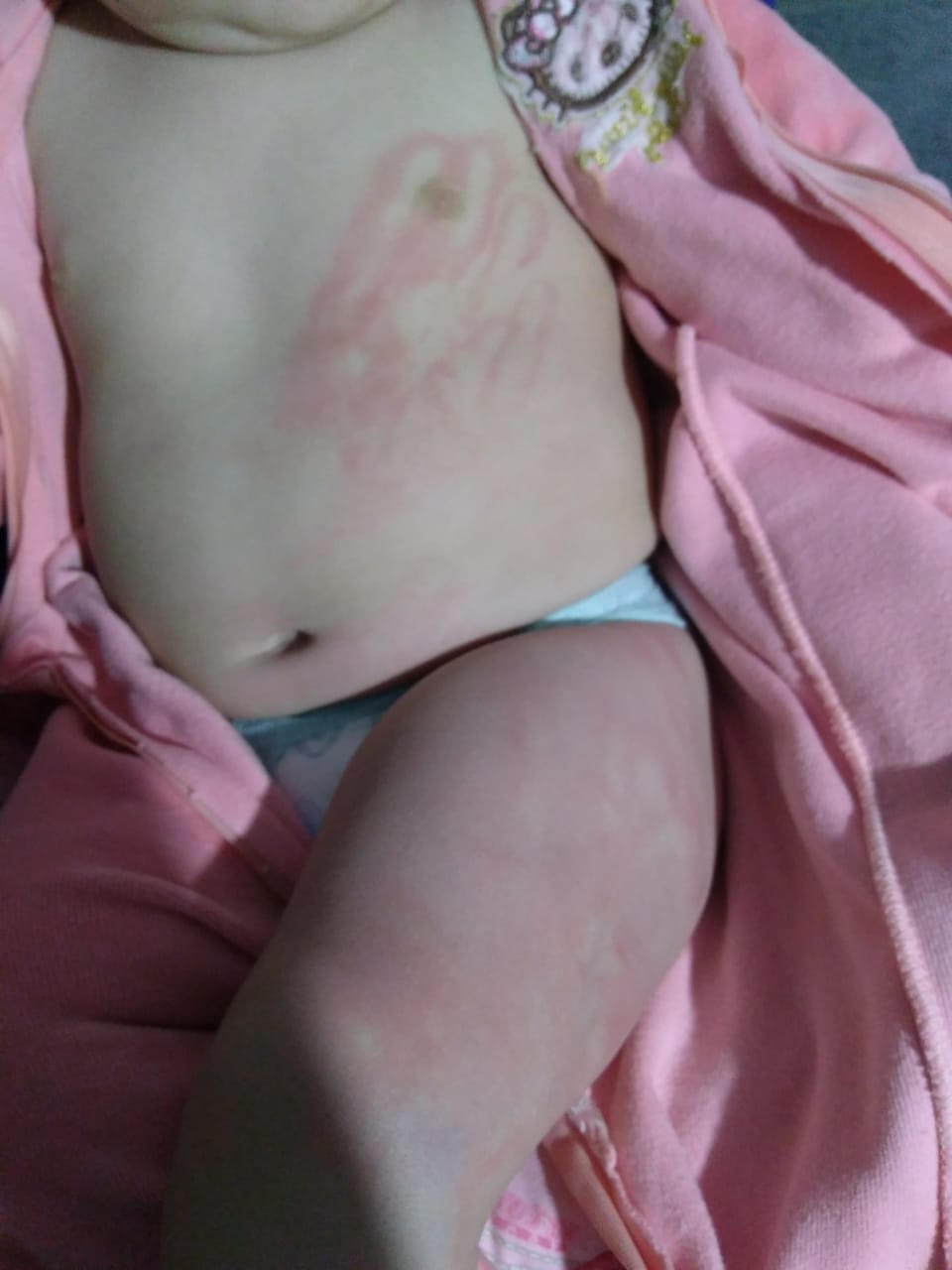 No estado: Pai agride filha de 6 meses