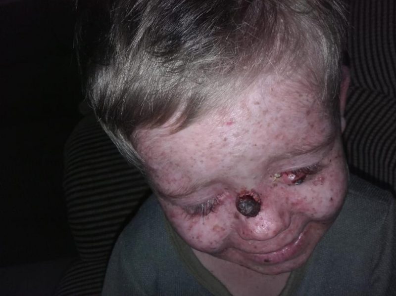 Arte à Mesa – Transformando Vidas: Jantar beneficente ajudará criança com doença rara